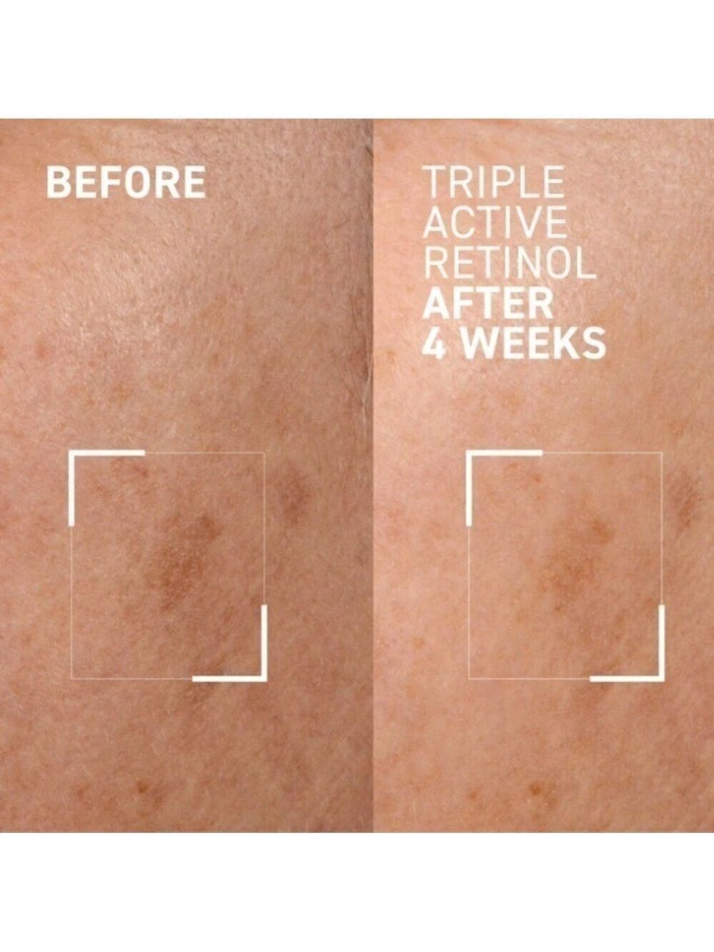 Dr. Brandt Bright This Way Triple Active Retinol Cream Renewal Lotion NWT - Picture 4 of 8